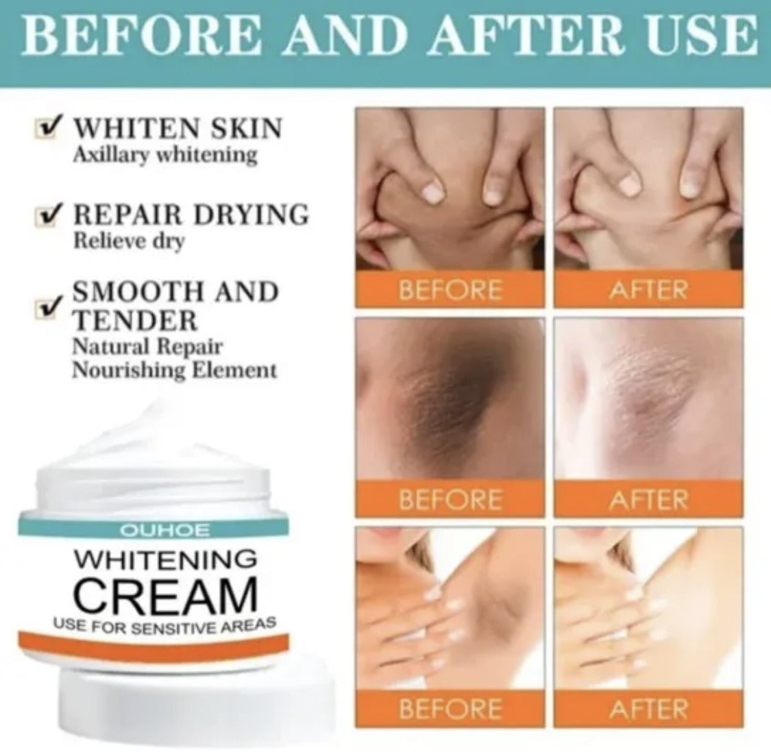 Whitening Cream for Private Parts, Underarms and Sensitive Area for Men and Women